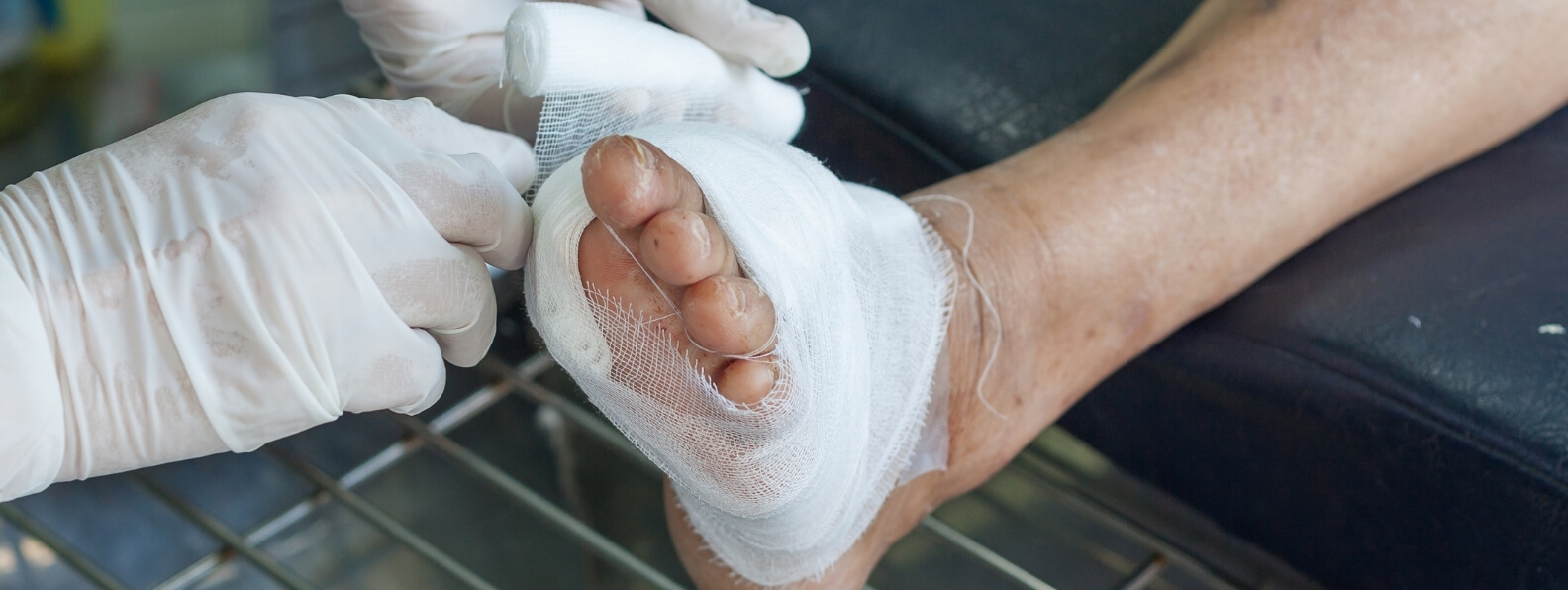 HBOT Success Rates in Chronic Wounds