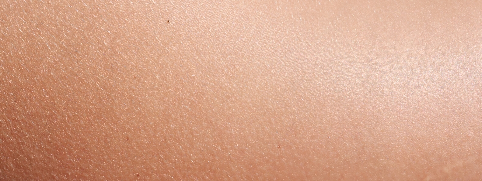 HBOT for Compromised Skin Grafts