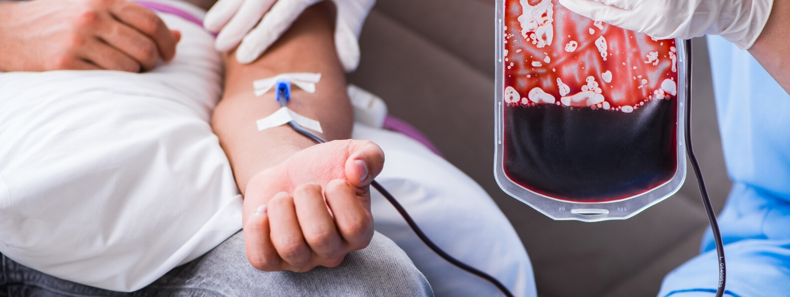 HBOT for Severe Anemia